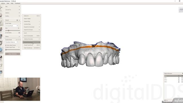 DigitalDDS - Meshmixer - Basics_30