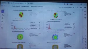 Исследователь, парапсихолог, кибернетик Эльмира Скиба, Новокузнецк. Диагностика действия фуллерена.