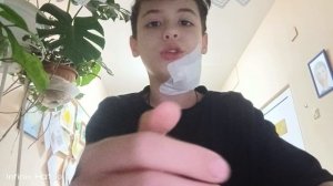 МОИ ШРАМЫ/ КАК НА ЗАБРОШКЕ МНЕ ПРОБИЛИ ЛОБ