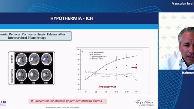 Temperature Control in ICM - Vascular Brain Injury webinars ESICM 25