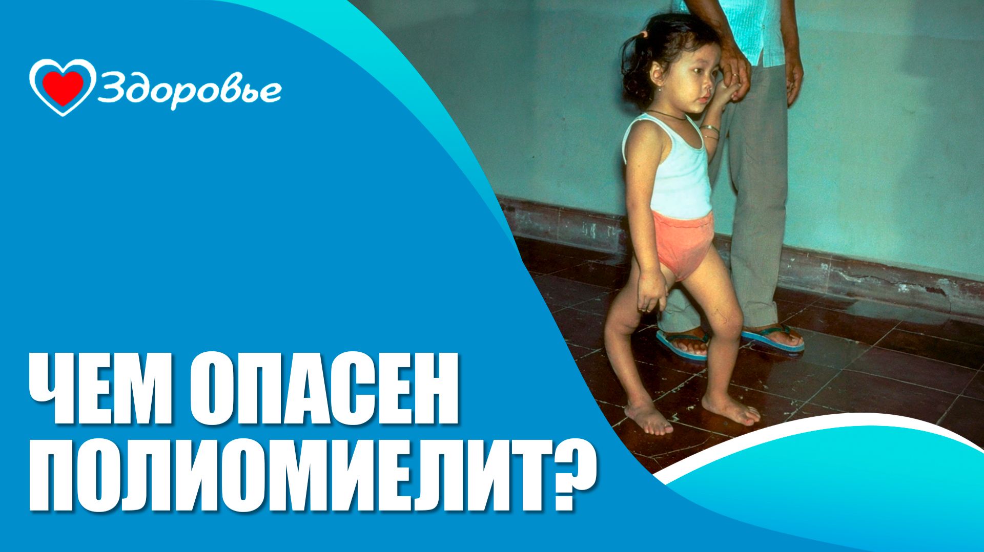 Здоровье. Почему полиомиелит остаётся угрозой: последствия отказа от вакцинации