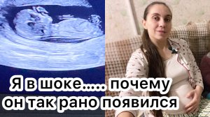 С таким я сталкиваюсь впервые 🫣