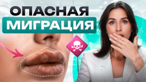 Как избежать миграции | Филлеры мигрируют