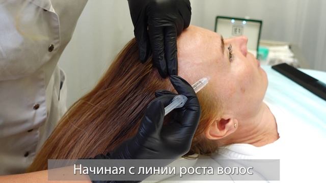 процедура трихология смотреть онлайн