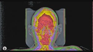 КТ   МРТ   (ПИКНИК)