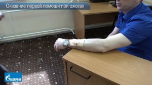 6. Оказание первой помощи при ожогах