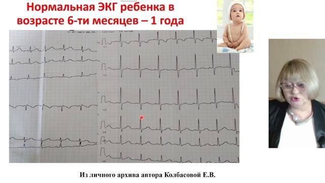 ЭКГ в педиатрии в возрастном аспекте