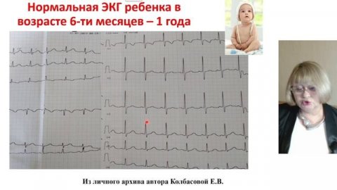 ЭКГ в педиатрии в возрастном аспекте