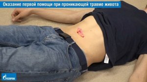 21. Оказание первой помощи при проникающей травме живота