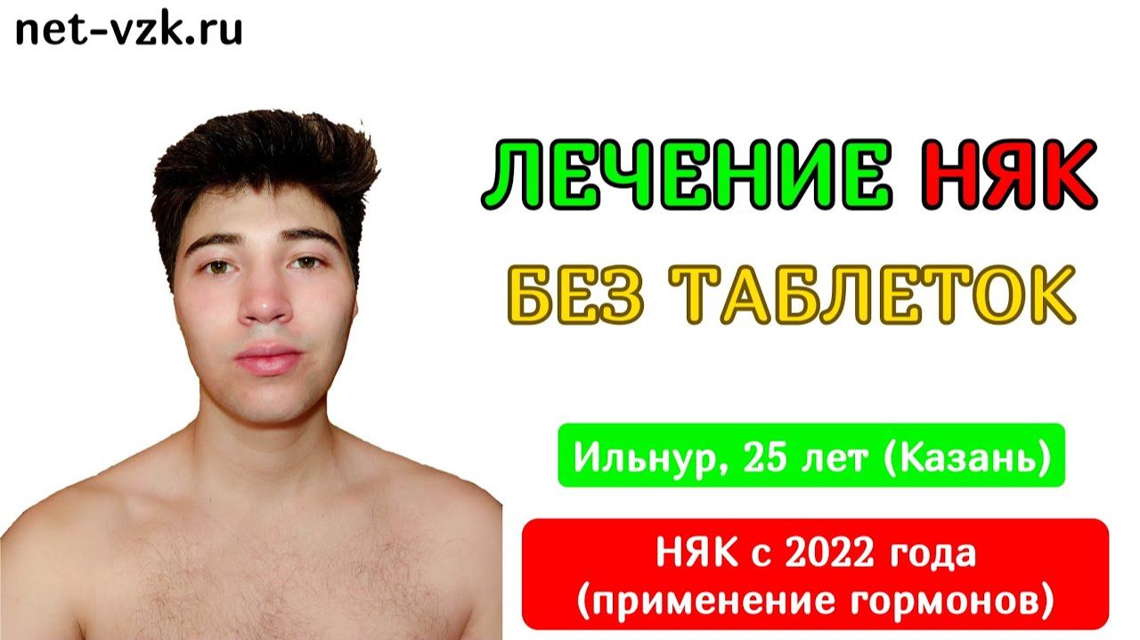 Язвенный колит без приёма препаратов - отзыв пациента о лечении няк