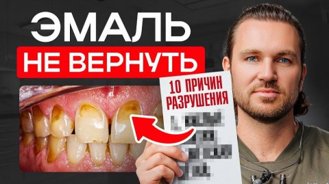 10 факторов, необратимо разрушающих эмаль – главную защиту здоровья и красоты зубов. Что делать?