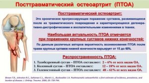 Современные подходы к комплексному лечению пациентов с переломами плато большеберцовой кости.