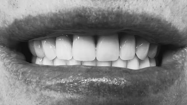 Протезирование полными съемными протезами в Липецке. Врач стоматолог Черных Максим Игоревич.