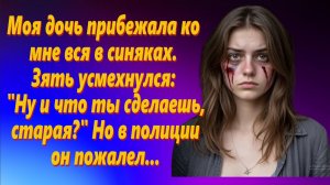 Моя дочь прибежала ко мне вся в синяках. Зять усмехнулся: