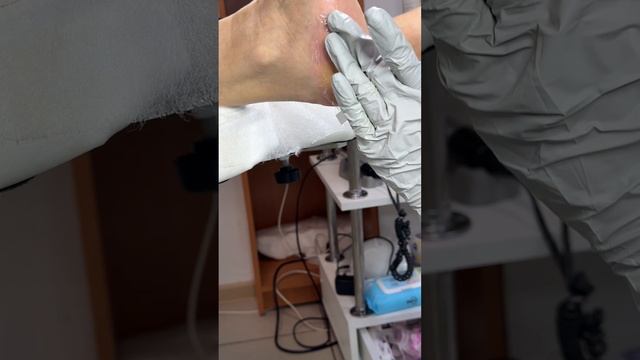 Маска от трещин на стопах и пятках