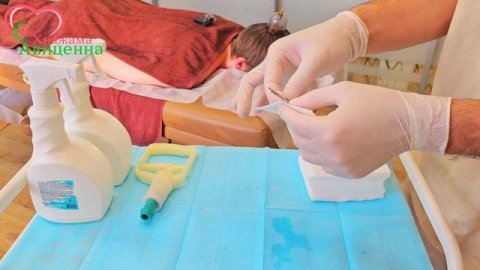 Хиджама на голову без бритья волос.