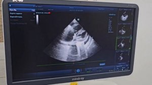 Сердце не выдержит наркоза... Страшная правда о здоровье несчастной кошки | Агата