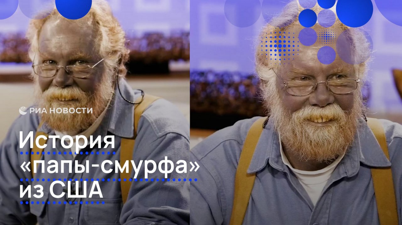 История "папы-смурфа" из США