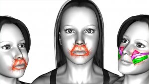 Избавление от Жира на ЛИЦЕ и Двойного ПОДБОРОДКА, подтяжка лица, похудение