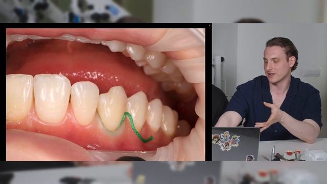 Михаил Баркушин - знание композитов для терапевтов и ортопедов | Кейсология