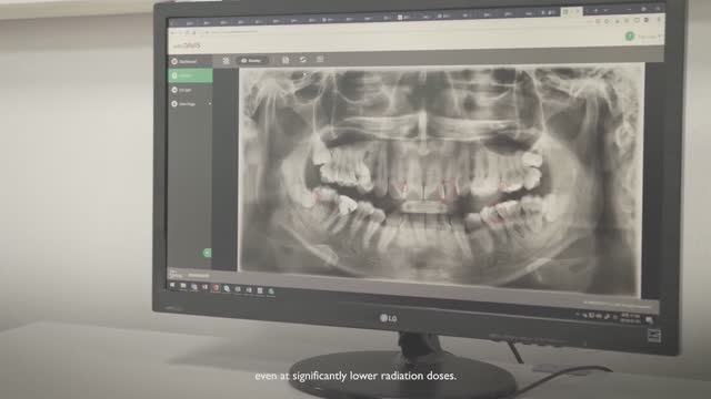 The Science of Low Dose — Vatech CBCT Proven Results