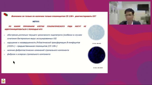 Хронический эндометрит. Дискуссионные вопросы смотреть онлайн