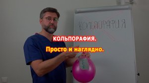 Опущение матки. Операция без "сетки".