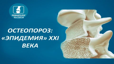 Остеопороз, "эпидемия" XXI века