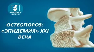 Остеопороз, "эпидемия" XXI века