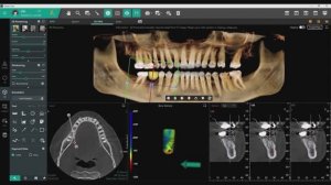 Vatech Clever One Introduction Video