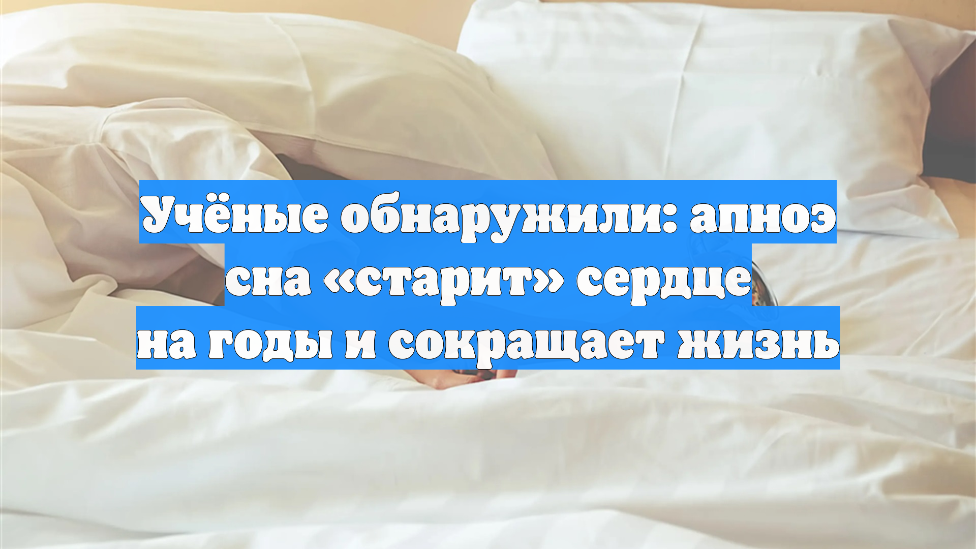 Учёные заявили, что апноэ сна «старит» сердце и отнимает годы жизни