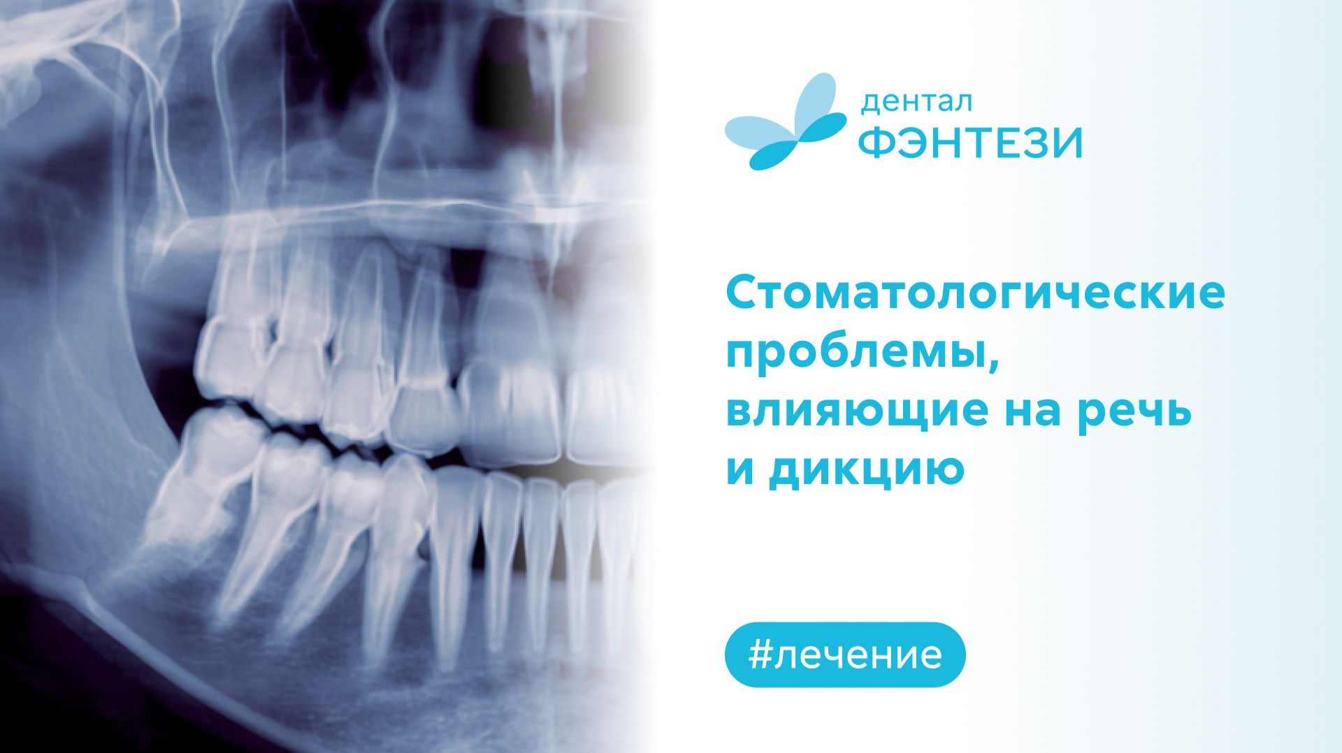 Стоматологические проблемы, влияющие на речь и дикцию