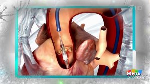 Галоп в сердце: когда ритм говорит о проблеме. Жить здорово! Фрагмент выпуска от 15.12.2025