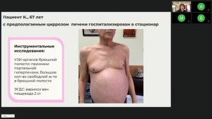 Интернет-конференция "Личный навигатор в ведении пациента с циррозом печени"