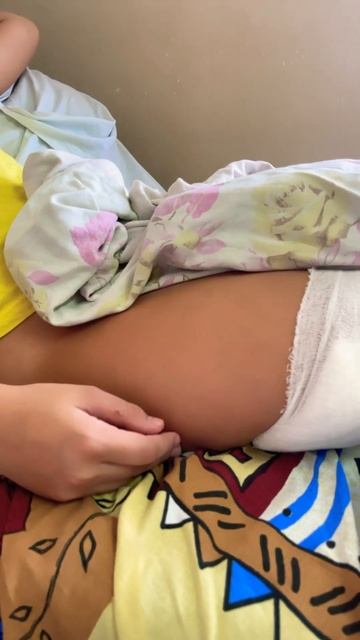 Третий день после операции  включаем мышцы задней поверхности бедра и ягодицы ￼