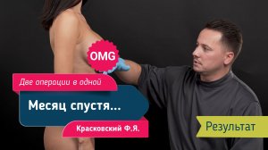 Восторг после операции! Результат через 30 дней | Красковский Фёдор Янович
