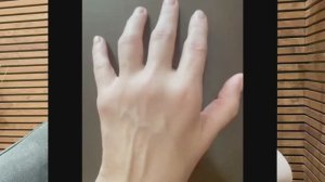 Ревматоидный артрит излечим, победим. Часть 2. Интервью через 1,5 года.