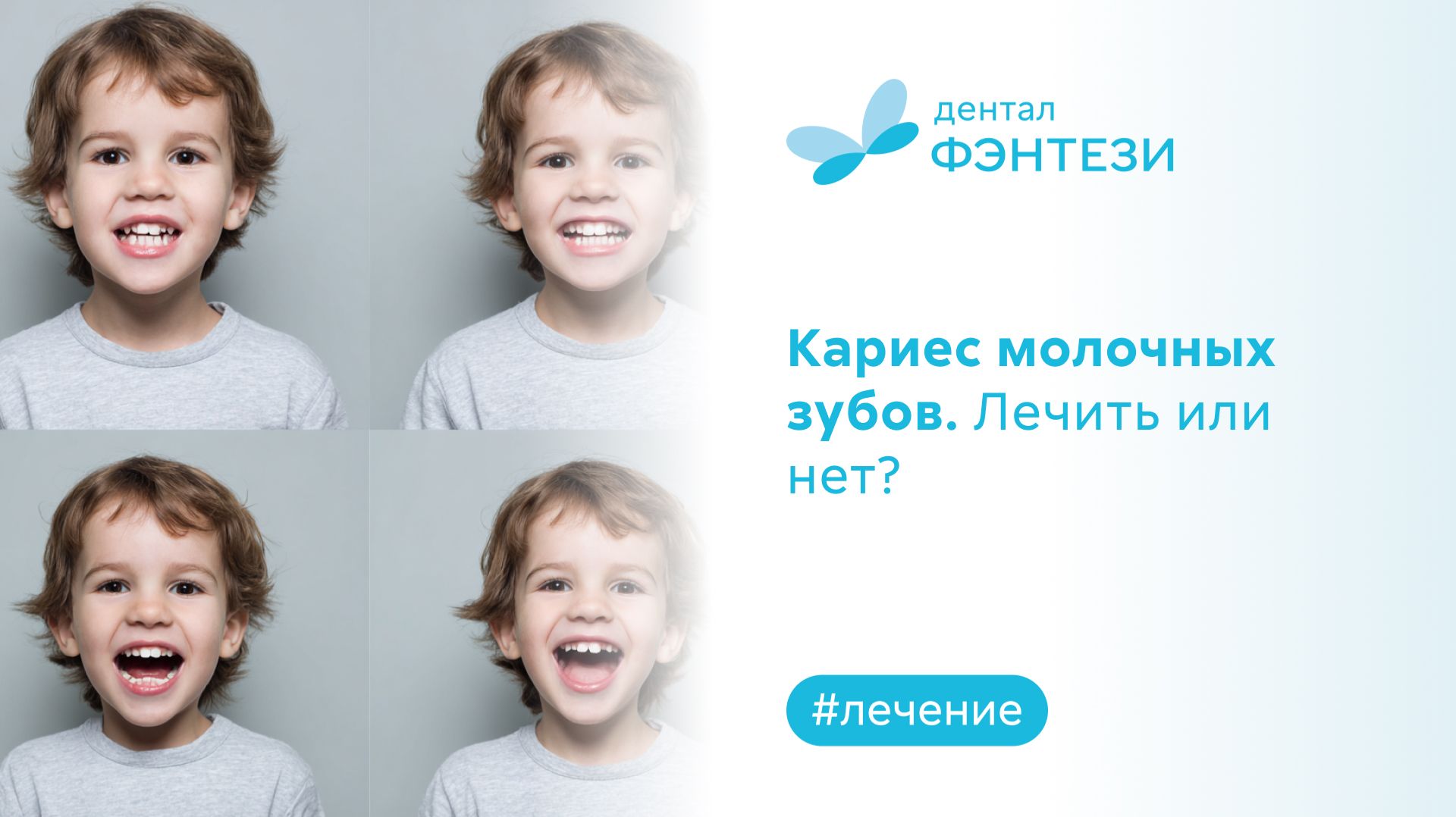 ❓ Кариес молочных зубов. Лечить или нет?