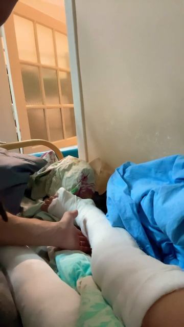 Локальная укладка конечностей в первый день после ￼операции