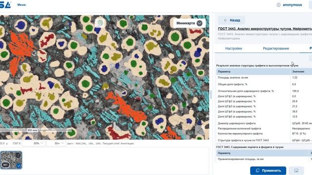 Нейрометодики анализа изображений SIAMS