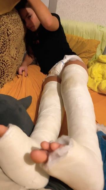 8-й день после операции   мах ногой вперёд и назад из положения лёжа на ￼боку