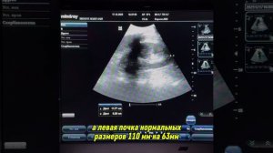 Вторично сморщенная почка при FAST-протоколе: что нужно знать👇🏻