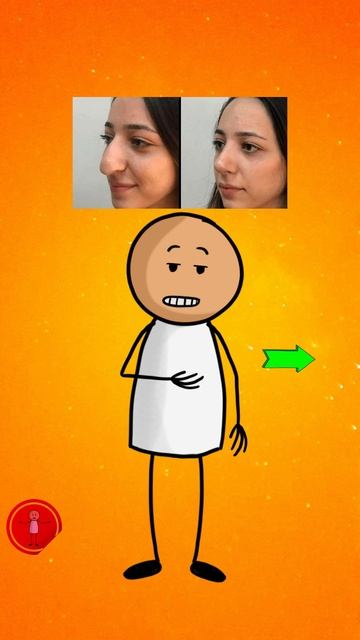 Рина пластика Медведевой