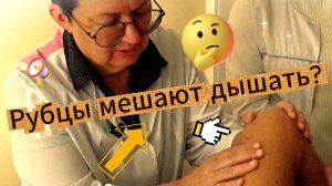 Что скрывает старый шрам?