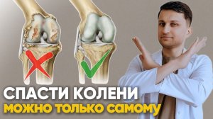 Лечебная физкультура для коленных суставов при артрозе 1-2 степени
