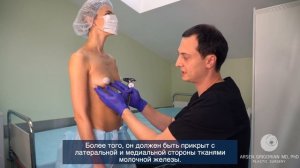 КАК ПОДОБРАТЬ ИМПЛАНТЫ ДЛЯ УВЕЛИЧЕНИЯ ГРУДИ?