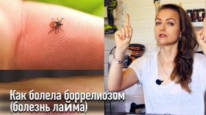 Как болела боррелиозом (болезнь лайма)