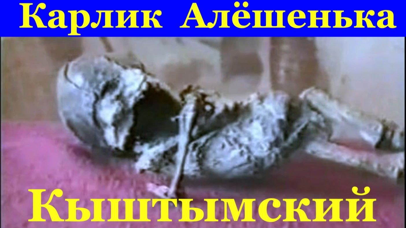 Кыштымский карлик Алёшенька инопланетянин гуманоид