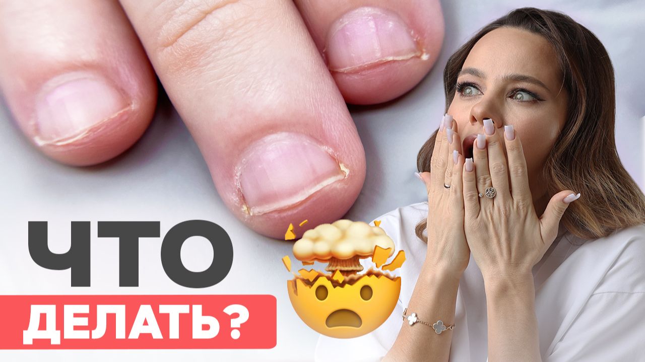 Самые сложные ногти для мастеров | Наращивание на обгрызенные смотреть онлайн