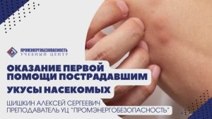 Первая помощь. Укусы насекомых